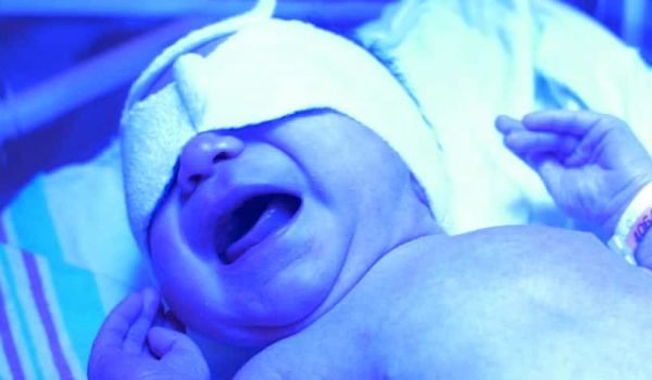 Neonatal Phototherapy Eye Mask DreamsTrip